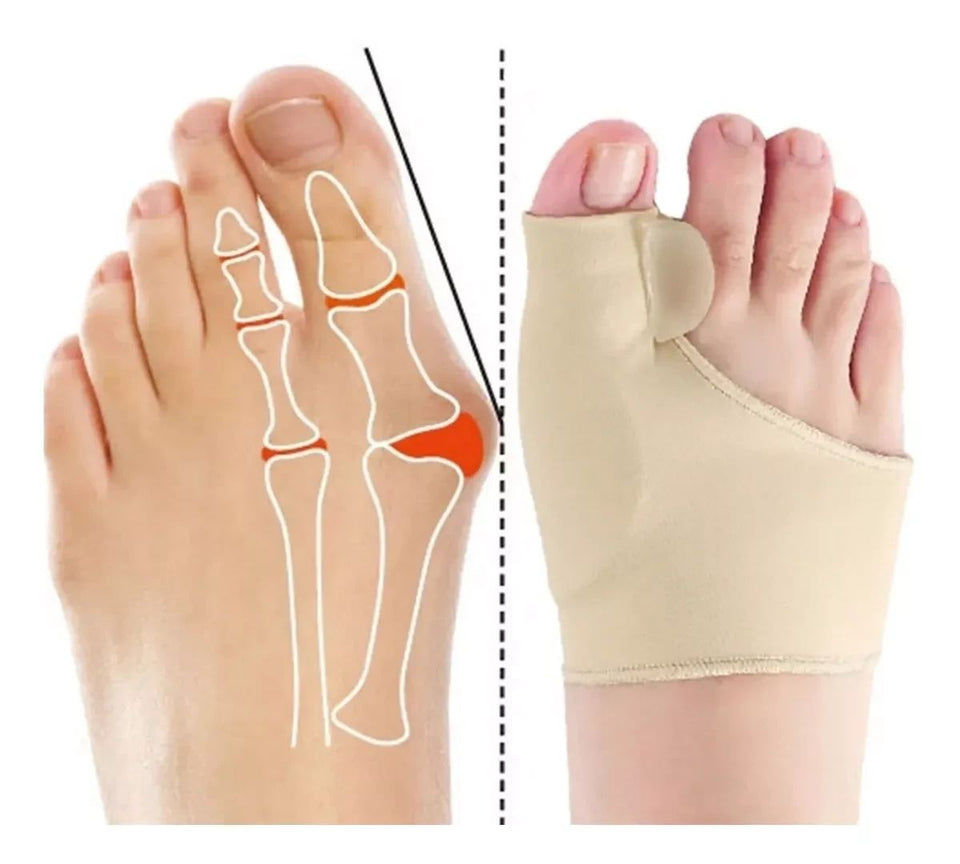 CORRECTOR DE JUANETE